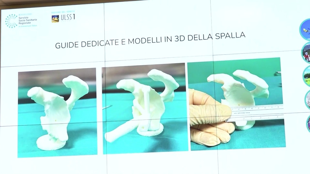 Tecnologia, giovani, specializzazione e collaborazione: così l'ortopedia resta d'eccellenza
