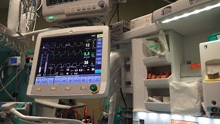 Ulss Dolomiti, il bilancio di previsione ipotizza una perdita di 74 milioni