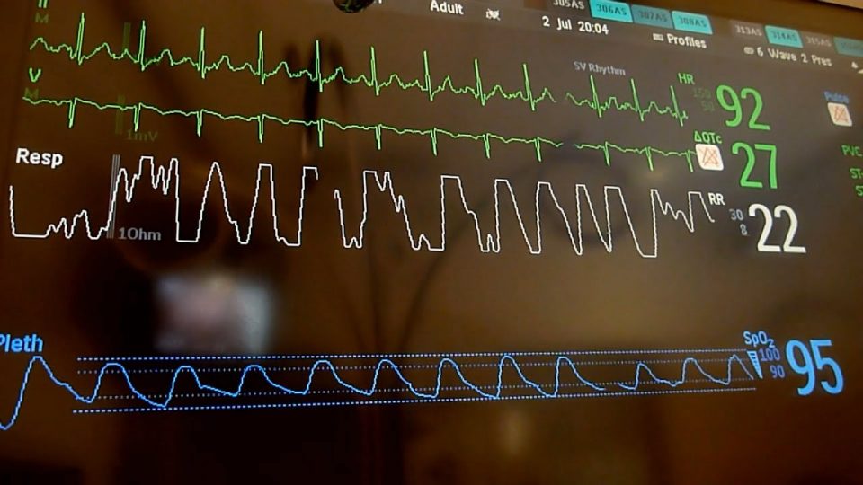 Oltre 2.500 elettrocardiogrammi “letti” a distanza in sei mesi per il servizio da remoto dell’Ulss