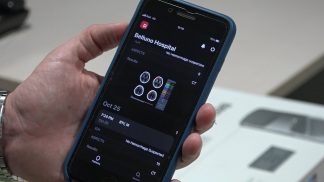 Le informazioni dalla TAC al cellulare: intelligenza artificiale a servizio della diagnosi di Ictus
