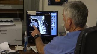 Prestazioni in aumento per l’Otorinolaringoiatria di Belluno, che nel frattempo avvia nuovi servizi